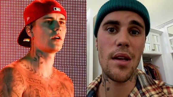 பிரபல பாப் பாடகர் ஜஸ்டின் பீபர் முக பக்கவாத நோயால் பாதிப்பு 