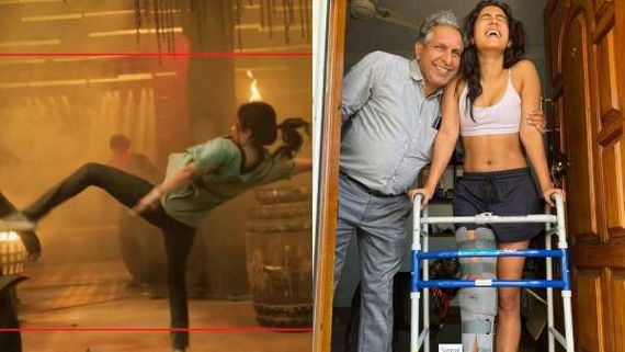 தசைநார் கிழிந்து விட்டது..விபத்துக்குள்ளான அதிர்ச்சி வீடியோவை வெளியிட்டு சம்யுக்தா ஹெக்டே வேதனை!