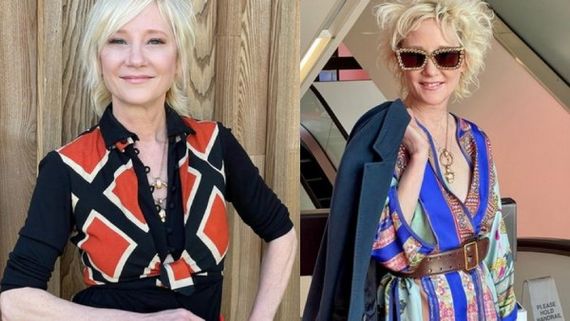 கோமாவில் ஹாலிவுட் நடிகை..கைவிரித்த மருத்துவமனை..கவலையில் ரசிகர்கள்!