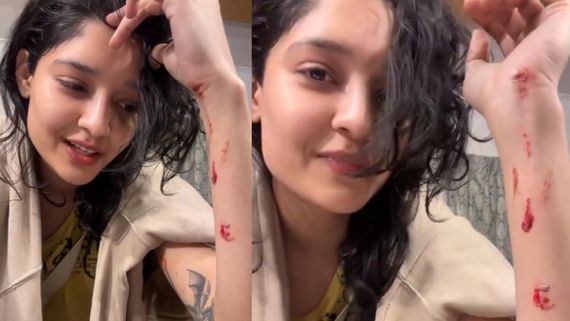  Actress Ritika singh: தலைவர் 170 பட சூட்டிங் ஸ்பாட்டில் விபத்து.. கையில் காயமடைந்த ரித்திகா!