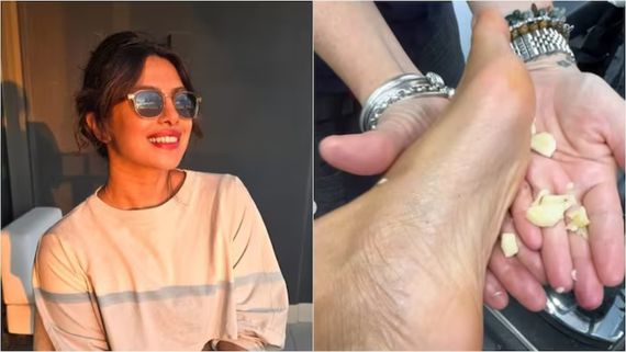 Priyanka Chopra: காலில் பலத்த காயம்.. பூண்டைத் தேய்க்கும் பிரியங்கா சோப்ரா.. ட்ரெண்டாகும் வீடியோ!