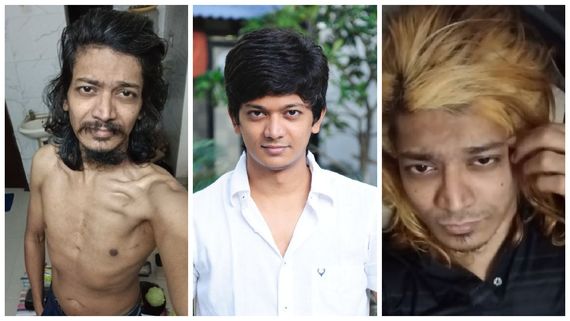 Shri:  2 வருஷத்தில் வாழ்க்கையே இப்படி ஆகிபோச்சே.. ஸ்ரீக்கு மருத்துவ உதவி தேவை.. அந்தணன் வேதனை!