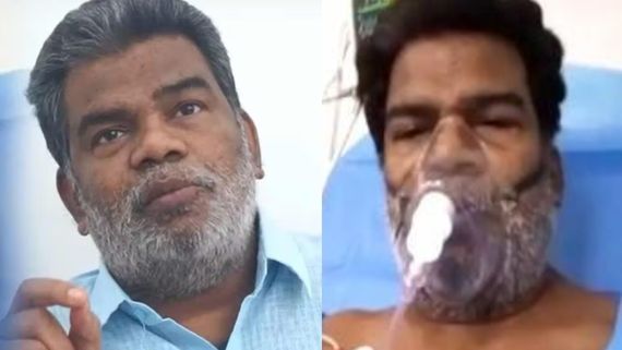 ஆசன வாய் அருகே அறுவை சிகிச்சை.. உருக்கமாக பேசிய பொன்னம்பலம்.. குணமாக இத்தனை மாதங்கள் ஆகுமா?