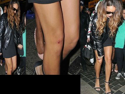 అభిమాని దాడి‌లో గాయపడిన సెక్సీ బ్యూటీ...(ఫోటోలు)