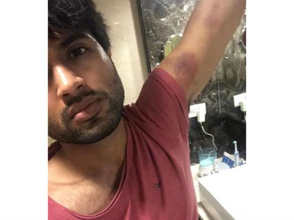 వైరల్ అవుతున్న ఫోటో....  విజయ్ దేవరకొండకు ఏమైంది? 