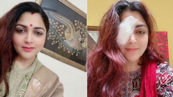 అలా ఎలా జరిగింది.. కత్తితో కంటికి గాయం.. కుష్బూ ఫోటో వైరల్