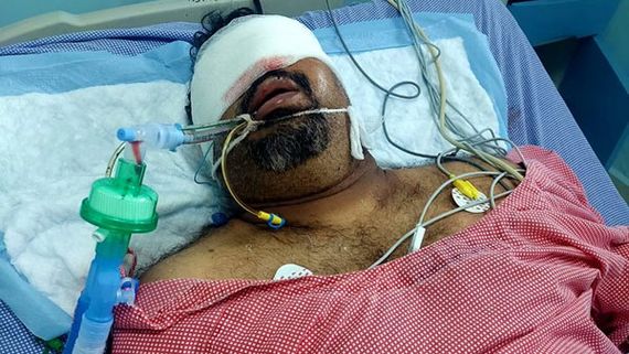 Mahesh Kathi Accident News: మూడు రోజులు కోమాలో, పూర్తి వివరాలు వెల్లడించిన డైరెక్టర్!