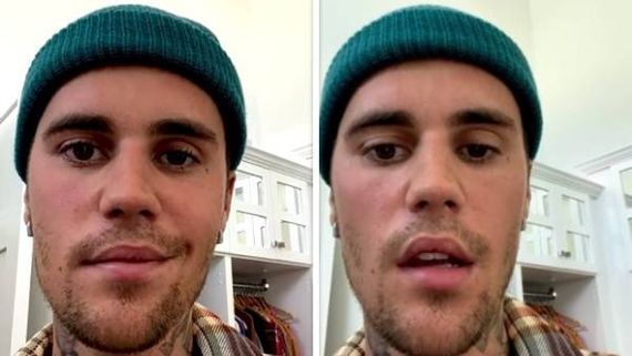  Justin Bieber కు తీవ్ర అనారోగ్యం.. స్ట్రోక్‌తో పక్షవాతం.. భారత్ టూర్ వాయిదా!