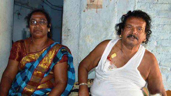 బలగం మొగిలయ్య పరిస్థితి విషమం.. హైదరాబాద్‌కు తరలింపు.. అసలు ఏమైందంటే?