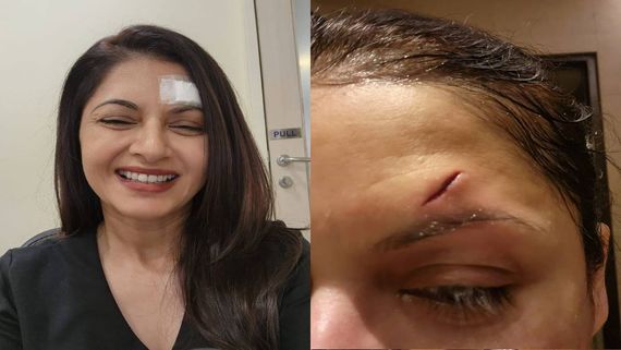 స్టార్ హీరోయిన్‌కి పెను ప్రమాదం.. తలకి 13 కుట్లు, బ్యాండేజ్‌తో ఫోటోలు లీక్