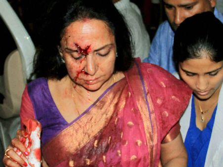 हेमा मालिनी कार एक्सीडेंट- बसंती की चिंता करो, बच्ची मर गयी वो सेलिब्रिटी तो नहीं थी