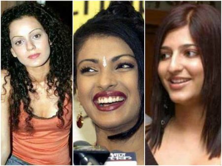 एक सर्जरी का कमाल...कहीं बवाल...कहीं बुरा है हाल!