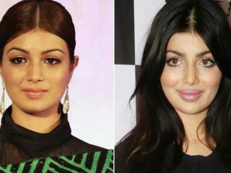 लिप सर्जरी पर ट्रोल हुईं थीं एक्ट्रेस..अब दिया बड़ा बयान