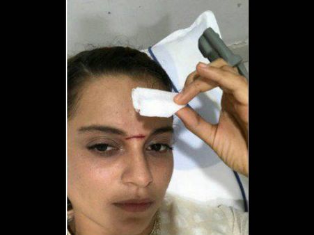 मणिकर्णिका के सेट पर चोटिल हुईं कंगना रनौत...लगे 15 टांके