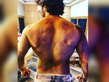 कलंक: शूटिंग के दौरान बुरी तरह से घायल हुए वरुण धवन, फैंस के लिए बुरी खबर