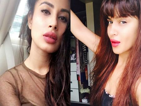 लिप सर्जरी से इन 7 सुपरस्टार का हुआ बुरा हाल, बिगड़ गई सूरत, तस्वीरें कर देंगी हैरान !