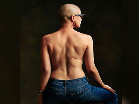 World Cancer Day: कैंसर से जूझ रहीं ताहिरा कश्यप ने पोस्ट की बोल्ड तस्वीर, दिया स्ट्रॉंग मैसेज