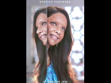 First LOOK: दीपिका पादुकोण की अगली फिल्म 'छपाक'- पहली झलक ही दमदार- DETAILS