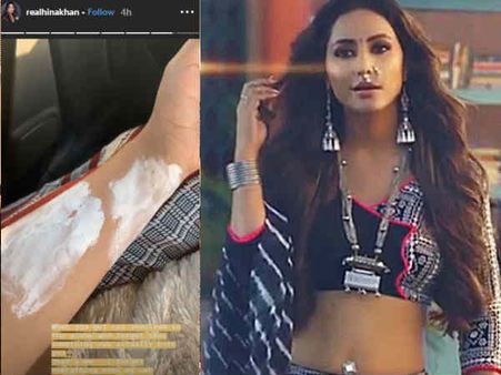 'कसौटी ज़िंदगी की' - शूटिंग के दौरान जला हिना खान का हाथ, वायरल हो रही है तस्वीरें