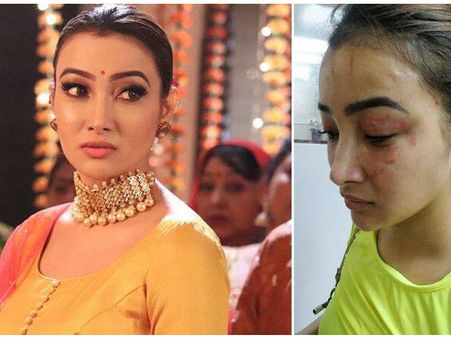 नामकरण फेम 'नलिनी नेगी' पर जानलेवा हमला, चेहरे बुरी तरह खराब, तस्वीरें वायरल