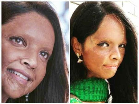 छपाक की कहानी - जानिए लक्ष्मी अग्रवाल के साथ क्या हुआ था उस भयानक दिन