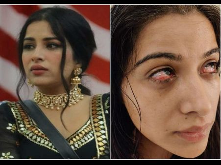 Bigg Boss 14: सारा गुरपाल को लगी भयानक चोट, निक्की ने किया अपने नाखूनों से हमला, दर्दनाक