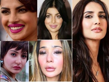 प्लास्टिक सर्जरी करवा इन हीरोइनों ने ऐसा बदला चेहरा, लोग हुए हैरान, उड़ाया मजाक-PICS