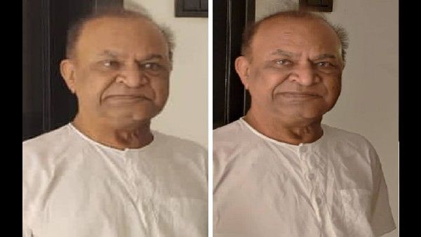 कैंसर का इलाज करवा रहे हैं तारक मेहता के नट्टू काका, सर्जरी के बाद तस्वीरें देख फैंस हैरान