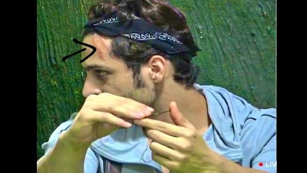 Bigg Boss 15: उमर रियाज को गंभीर चोट, आसिम रियाज ने दिखाई फोटो लिखा- दर्द की धार है