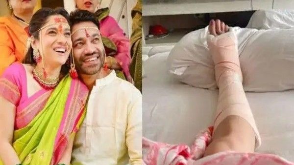 विकी जैन से शादी से पहले अंकिता लोखंडे के साथ हादसा, अस्पताल में भर्ती, पैर में लगी गंभीर चोट