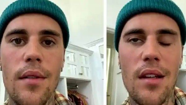 खतरनाक वायरस के कारण जस्टिन बीबर का चेहरा लकवाग्रस्त, सामने आया Video, देखिए गंंभीर हालत