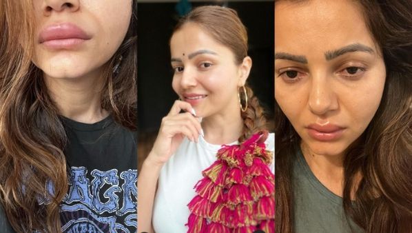 रुबीना दिलैक की खूबसूरती को लगी बुरी नजर! बिगड़ गया एक्ट्रेस का पूरा चेहरे, बोलीं- मेरी हालत अब...
