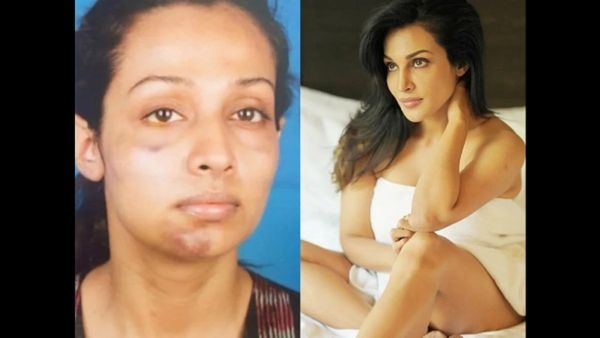 बॉयफ्रेंड ने इस एक्ट्रेस की कर दी थी ऐसी हालत कि मौत के मुंह से निकली हसीना, मार मारकर और तोड़ दिया जबड़ा
