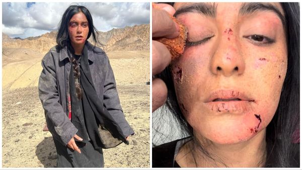 'द केरल स्टोरी' की एक्ट्रेस की हालत हुई खराब, आनन फानन में अस्पताल में भर्ती हुई हसीना