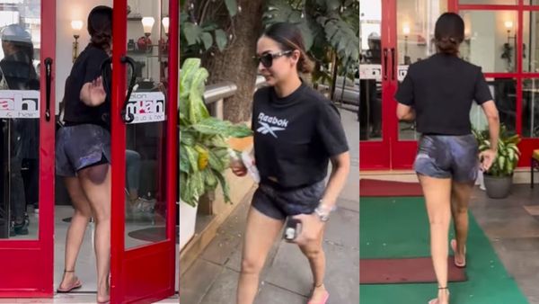 Malaika Arora के पैर पर बड़ा सा चोट का निशान देखकर लोग बोले- 'अर्जुन ने तवे पर बैठा दिया क्या?'