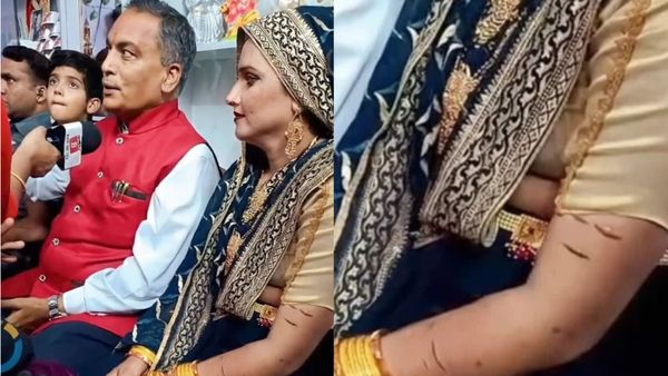 Seema Haider: मिल गया सबूत! तो क्या असल में सीमा हैदर के साथ होती है मारपीट? हाथ पर दिखे जले हुए निशान