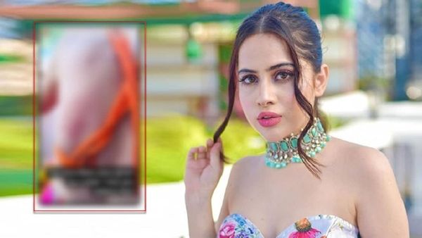 उर्फी जावेद के बदन पर पड़े गहरे गहरे डार्क लव बाइट, बिना कपड़ों के हसीना ने दिखाए और बताया किसने दिए