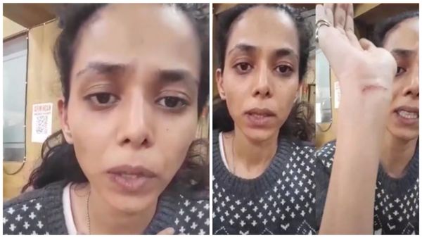 Vaishnavi Dhanraj: टीवी एक्ट्रेस के साथ परिवालों ने की मारपीट, गंभीर स्थिति में पहुंची पुलिस स्टेशन