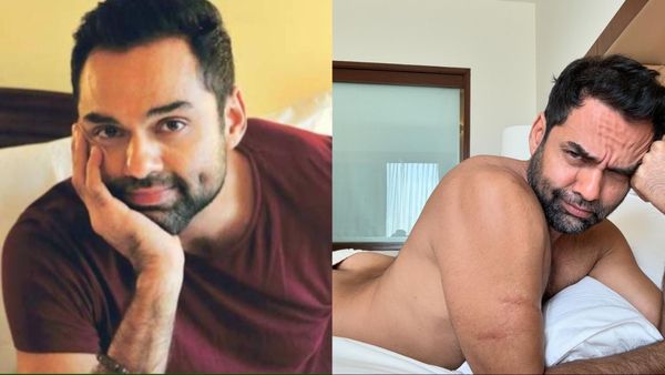 Abhay Deol ने कैमरे के सामने दिखाए अपनी छाती के बाल, फिर मुड़कर खिसका दी पैंट, फोटोज वायरल