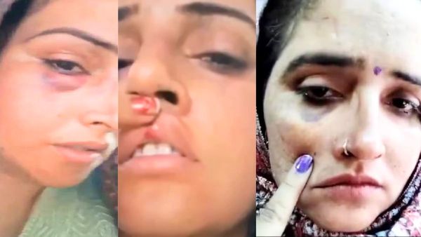 सचिन मीणा का खत्म हुआ सीमा हैदर के लिए प्यार, गुस्से में आकर बिगाड़ दिया पूरा चेहरा