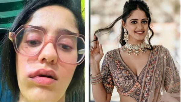 सूजता जा रहा है Ayesha Singh का चेहरा, डॉक्टर पर डॉक्टर बदले लेकिन बीमारी का नहीं लग पा रहा पता