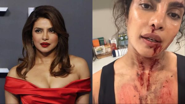 खून से लथपथ दिखीं Priyanka Chopra, फिल्म की शूटिंग में बुरी तरह से जख्मी हुई एक्ट्रेस