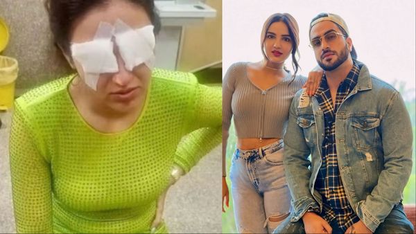 गर्लफ्रेंड Jasmine Bhasin की आंखों का हाल देखकर Aly Goni ने किया ये पोस्ट, शेयर की ऐसी फोटो