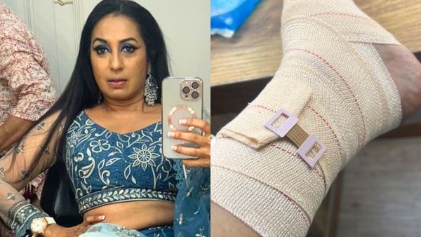 कश्मीरा शाह का हुआ एक्सीडेंट, हड्डी-पसली पर आई चोट, बोलीं- लोगों की बुरी नजर लग गई...