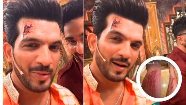 गोवा में हुआ अर्जुन बिजलानी का एक्सीडेंट, शरीर पर आए गहरे घाव के निशान