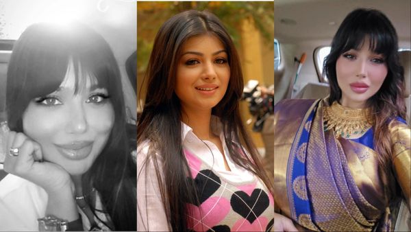 Ayesha Takia के चेहरे का हाल देखकर लोग हुए हैरान, प्लास्टिक सर्जरी करवाने के बाद इतनी ज्यादा बिगड़ गई सूरत