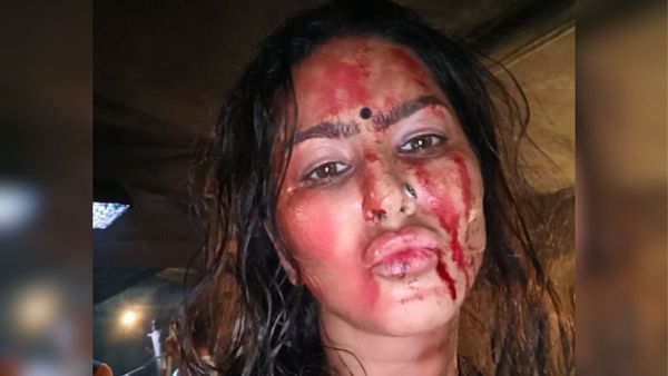 Sunny Leone का ऐसा हाल देख दंग रह गए फैन्स, बिगड़ गया पूरा चेहरा, खून से लथपथ एक्ट्रेस बोलीं- ये मेहनत का...