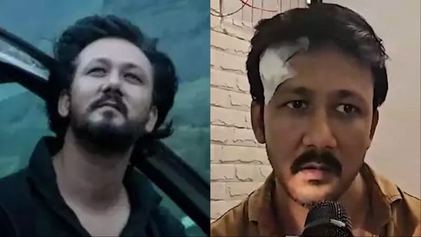 इस एक्टर ने बड़े एक्शन डायरेक्टर के बेटे पर लगाया आरोप, कहा- 'मुझे चाकू से मारा और सिर पर रॉड से वार किया'
