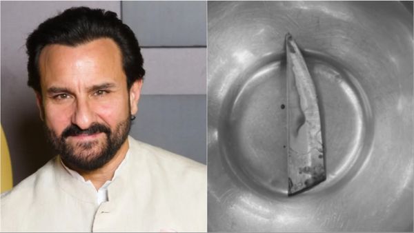 Saif Ali Khan की पीठ पर धंसे खंजर की फोटो हुई वायरल, 2mm चाकू और अंदर जाता तो एक्टर की...