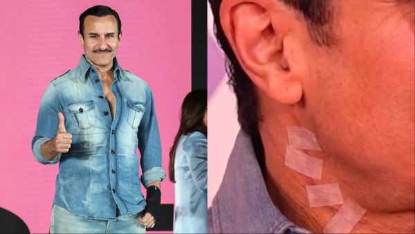 मूवी का प्रमोशन करने आए Saif Ali Khan के गले पर चोट के साफ दिखे निशान, फोटोज हुईं वायरल